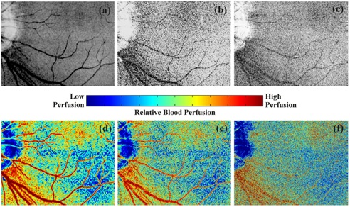 Non-invasive andin vivo dynamic imaging of microvasculature and tissue perfusion using laserspeckle contrast technique